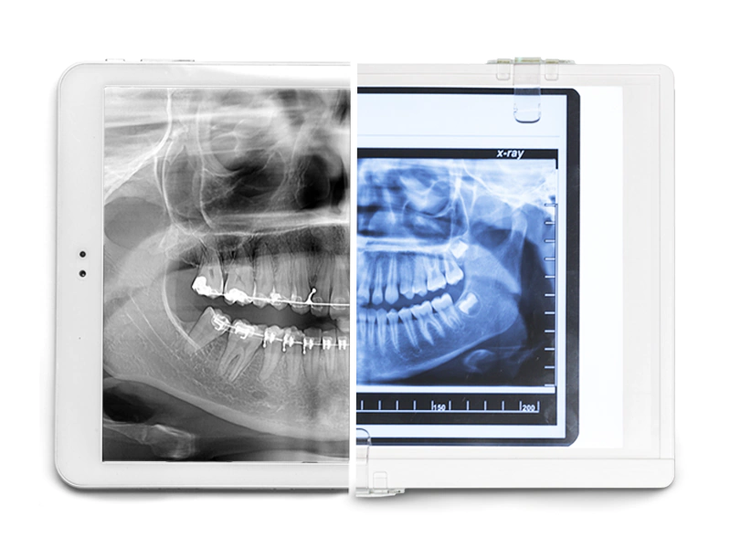 Dental X-Rays